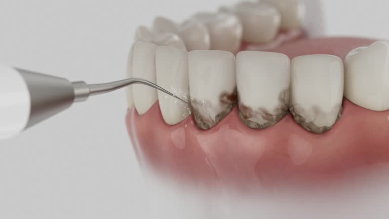 Reliable Emergency Dentist contractor in Harrison, NY by Smile Center Dentistry